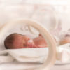 Common Reasons Why Birth Injuries Occur