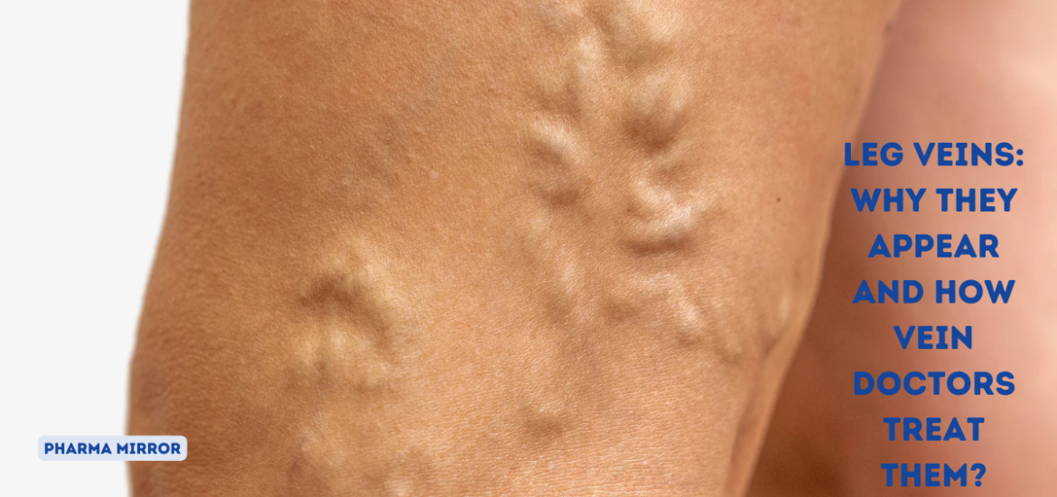 Leg Veins: Why They Appear and How Vein Doctors Treat Them