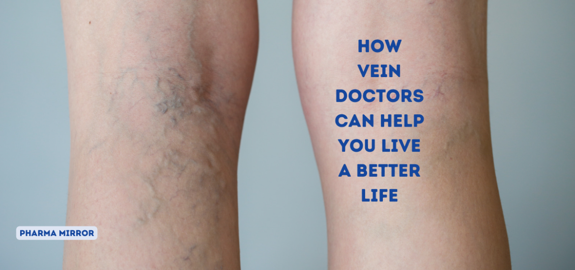 How Vein Doctors Can Help You Live a Better Life